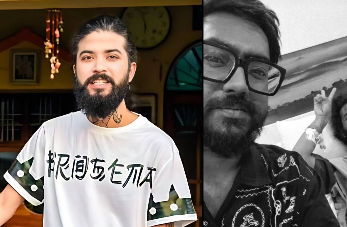 Anurag Dobhal Recovering After Car Crash During Instagram Live