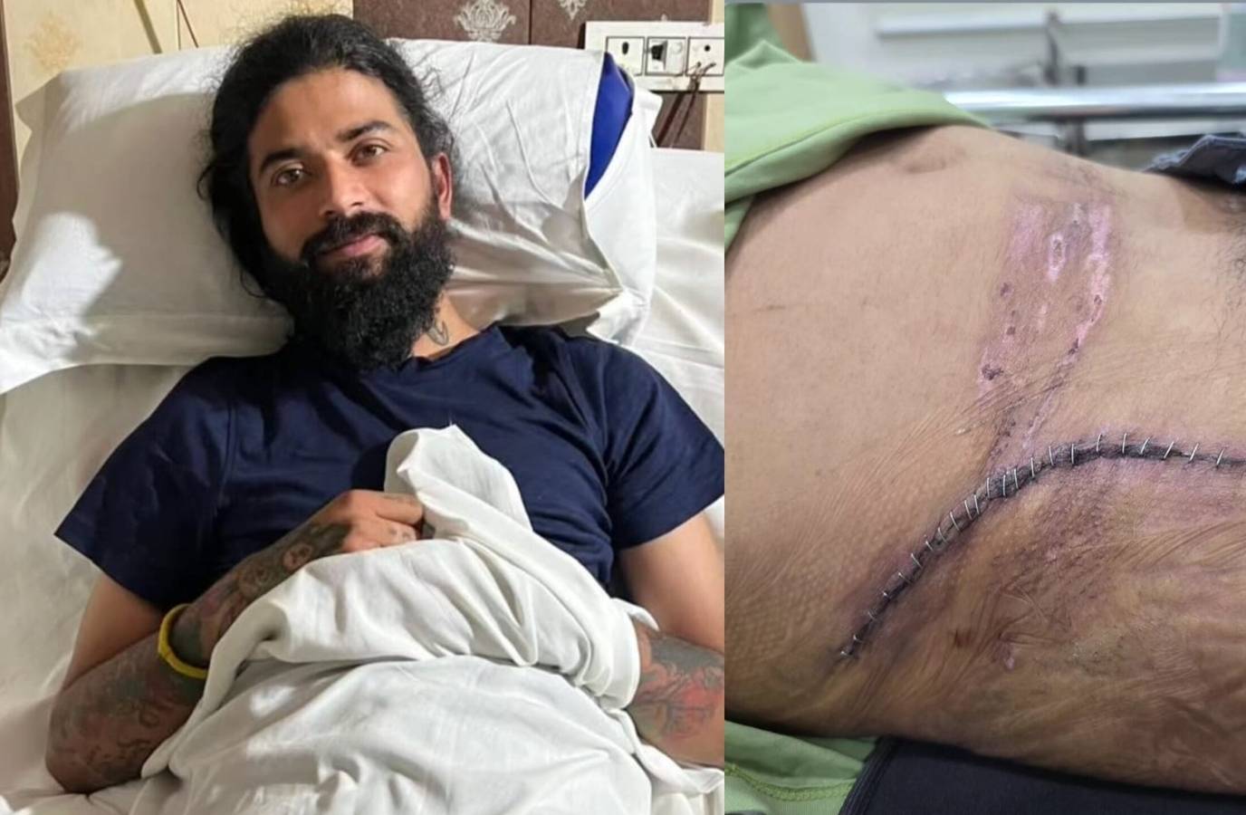 YouTuber Anurag Dobhal Seeks Fans' Advice on Comeback After Car Crash
