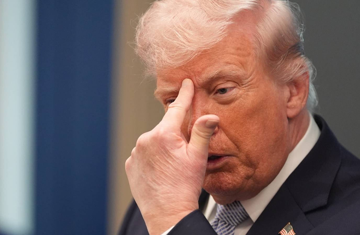 Trump's Health Rumors Intensify Amid Bald Spot Appearance